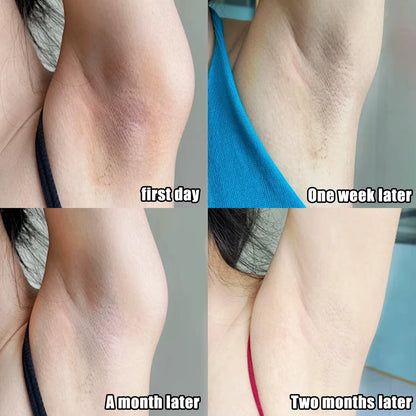 Body Moisturizing Underarm Whitening Cream Bleach Butt Knee Private Parts Melanin Brighten Lighten Dark Skin Care Women Beauty